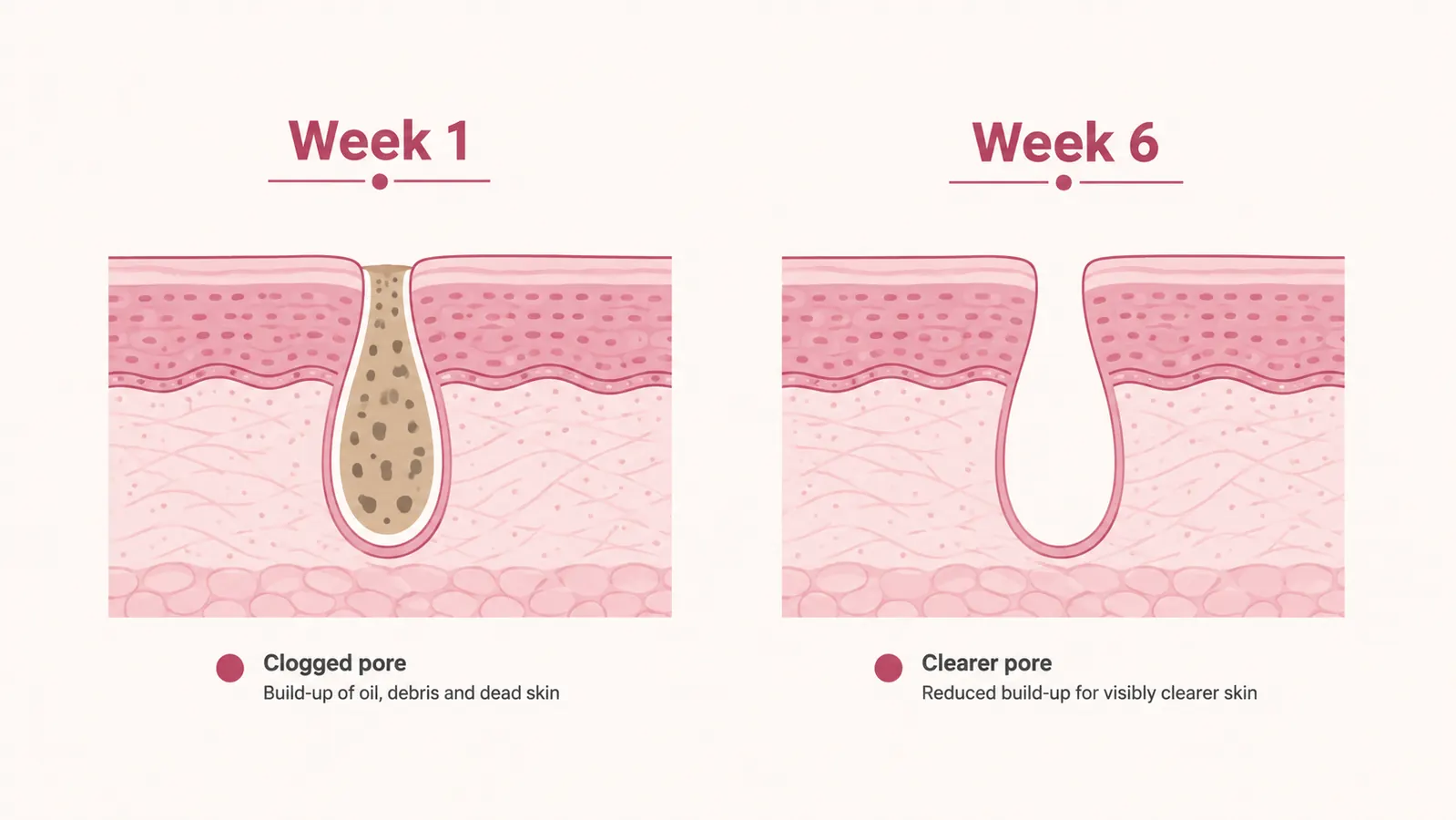 Side-by-side skin texture comparison chart showing pore appearance before and after 6 weeks of cleansing brush use